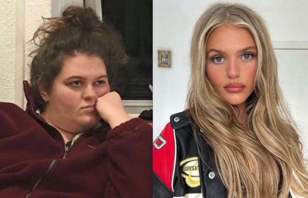 UK woman reveals “sad” revelation after 70 pound (32 kg) weight loss