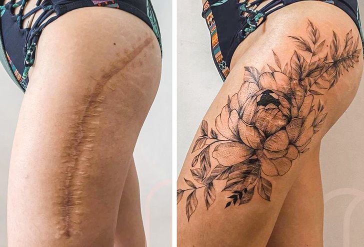The Transformation of 22 Scars Into Beautiful Tattoos