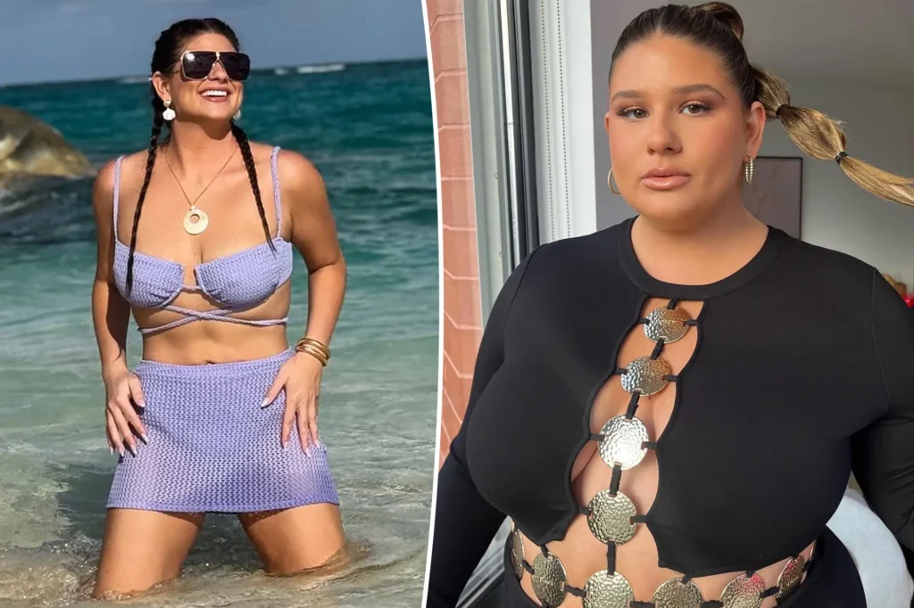 The Truth About Remi Bader’s Weight Loss Transformation