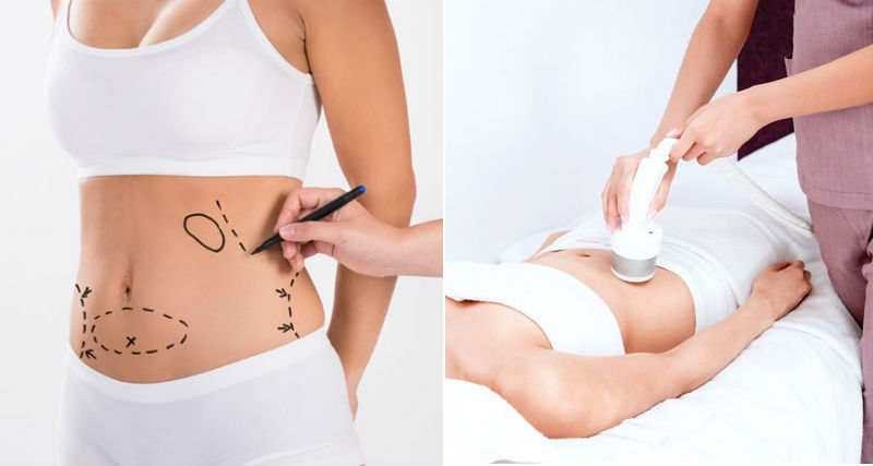 Coolsculpting Dos And Don’ts