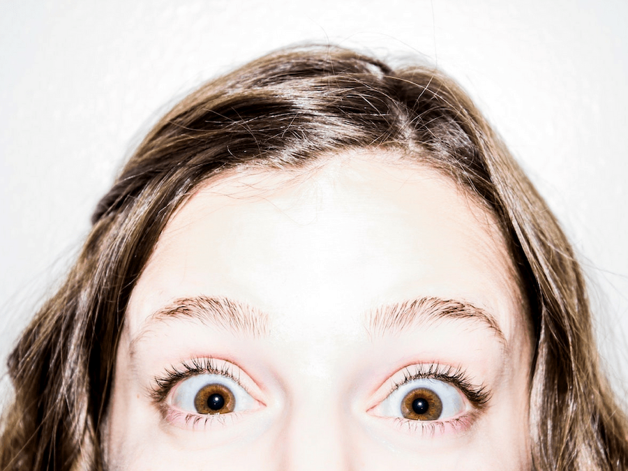 Things You Need To Know About Сrow’s Feet And How To Get Rid Of It