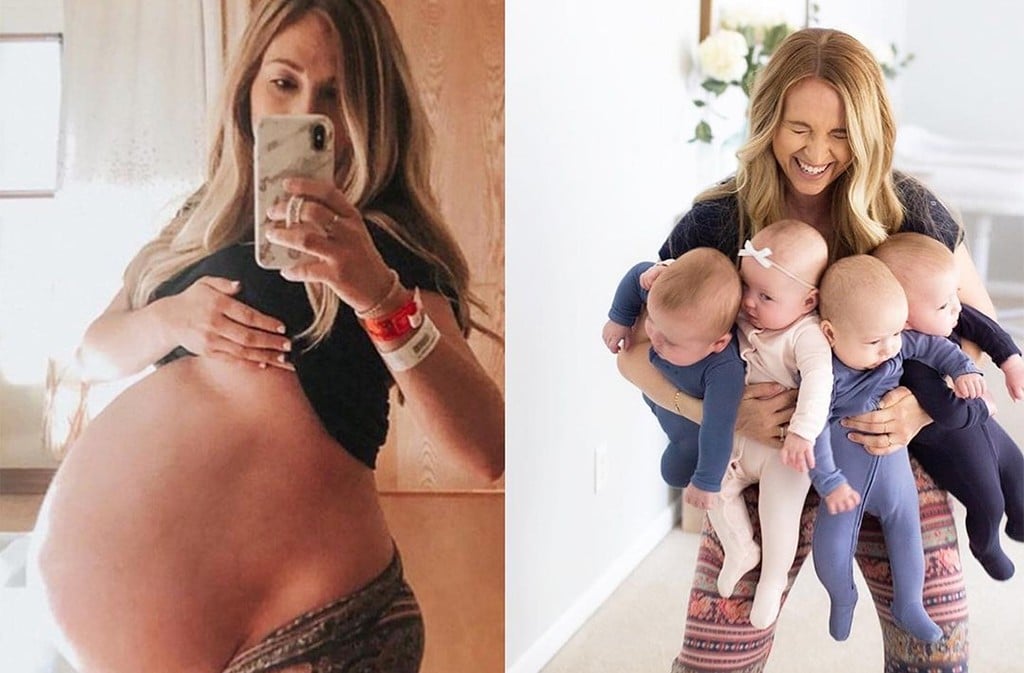 <strong>Quadruplet Mom’s Before and After Pregnancy Photos Are Incredible!</strong>
