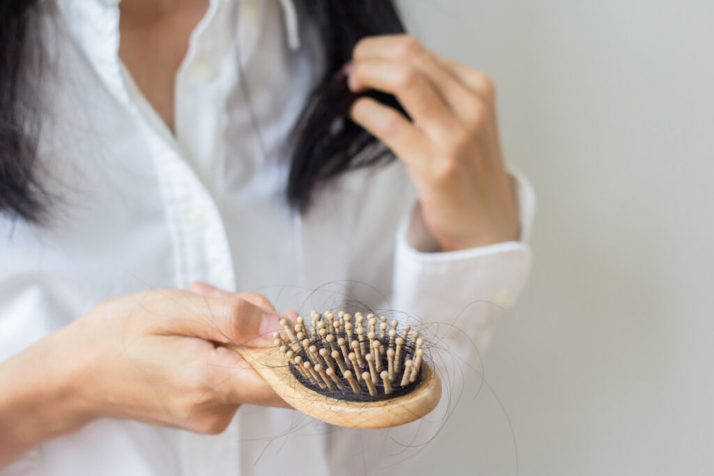 Post Covid Hair Loss And How To Prevent It